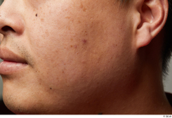 Man Asian Chubby Face Skin Textures